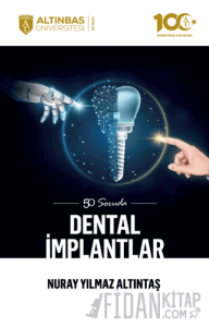 50 Soruda Dental İmplantlar