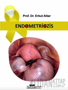 Endometriozis (Ciltli)