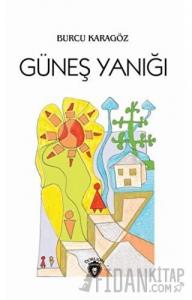 Güneş Yanığı