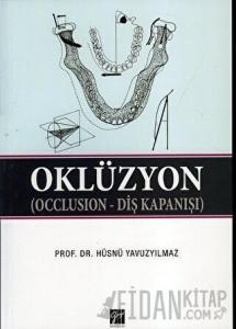 Oklüzyon
