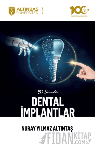 50 Soruda Dental İmplantlar
