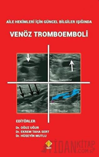 Aile Hekimleri İçin Güncel Bilgiler Işığında Venöz Tromboemboli