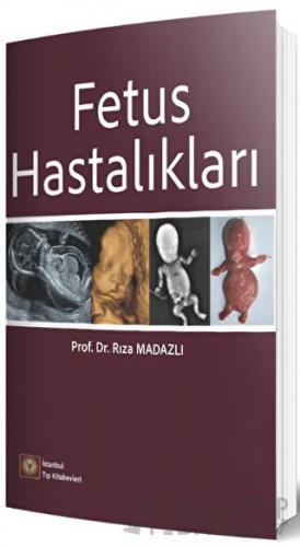 Fetus Hastalıkları