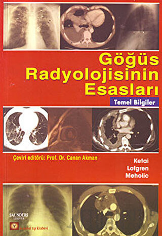 Göğüs Radyolojisinin Esasları