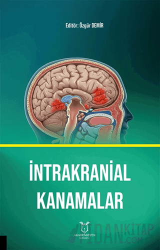 İntrakranial Kanamalar Kolektif