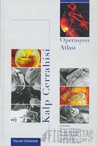 Kalp Cerrahisi Operasyon Atlası (Ciltli)