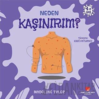 Neden Kaşınırım?