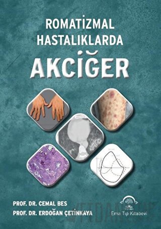 Romatizmal Hastalıklarda Akciğer (Ciltli)