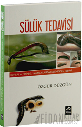 Ruhsal ve Fiziksel Hastalıklarda Geleneksel Tedavi - Sülük Tedavisi